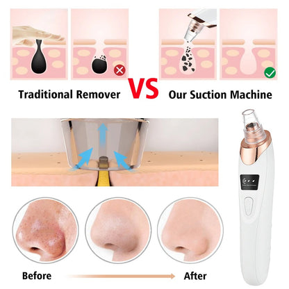 Electric Vacuum Facial Blackhead remover